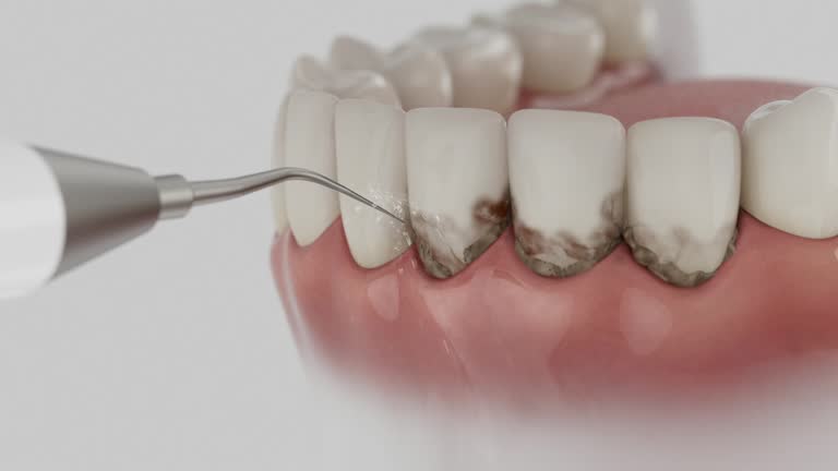 Reliable Tooth Extraction contractor in Linn County County, KS by Dentist Open Now